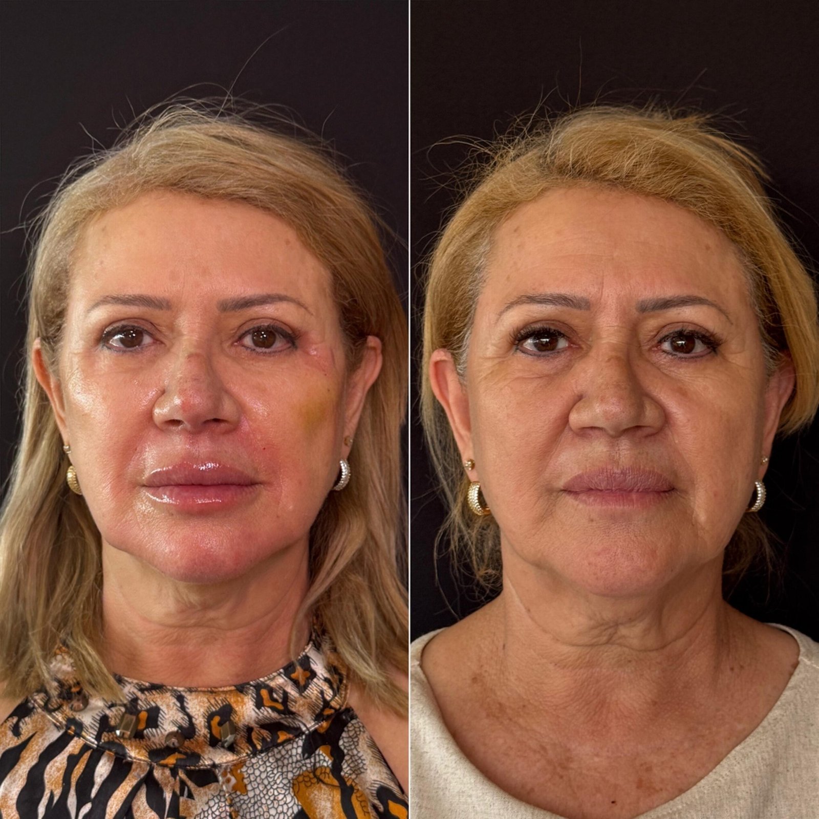 WhatsApp Image 2025-11-13 at 4.19.49 PM